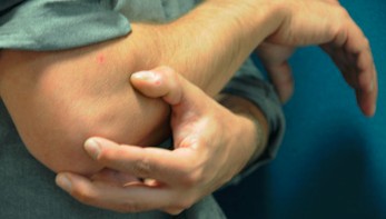 Acupuncture for Tennis Elbow